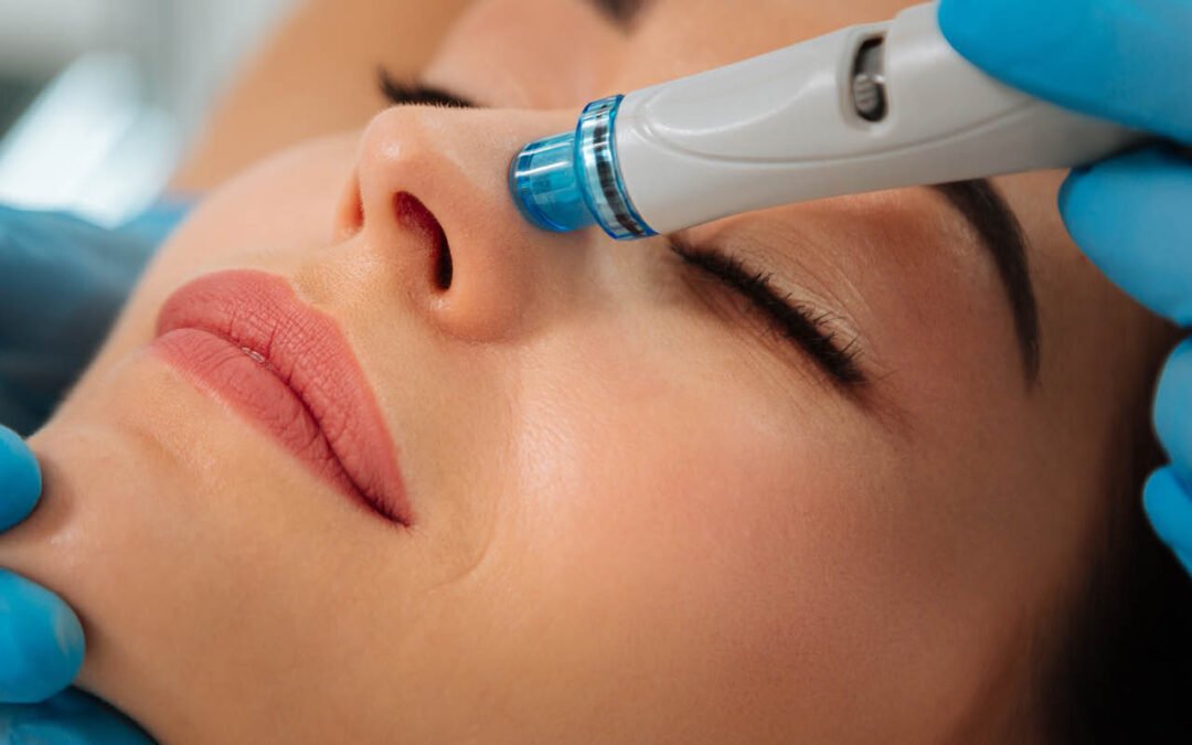 HydraFacial London: The Ultimate Guide to Glowing Skin in 2026