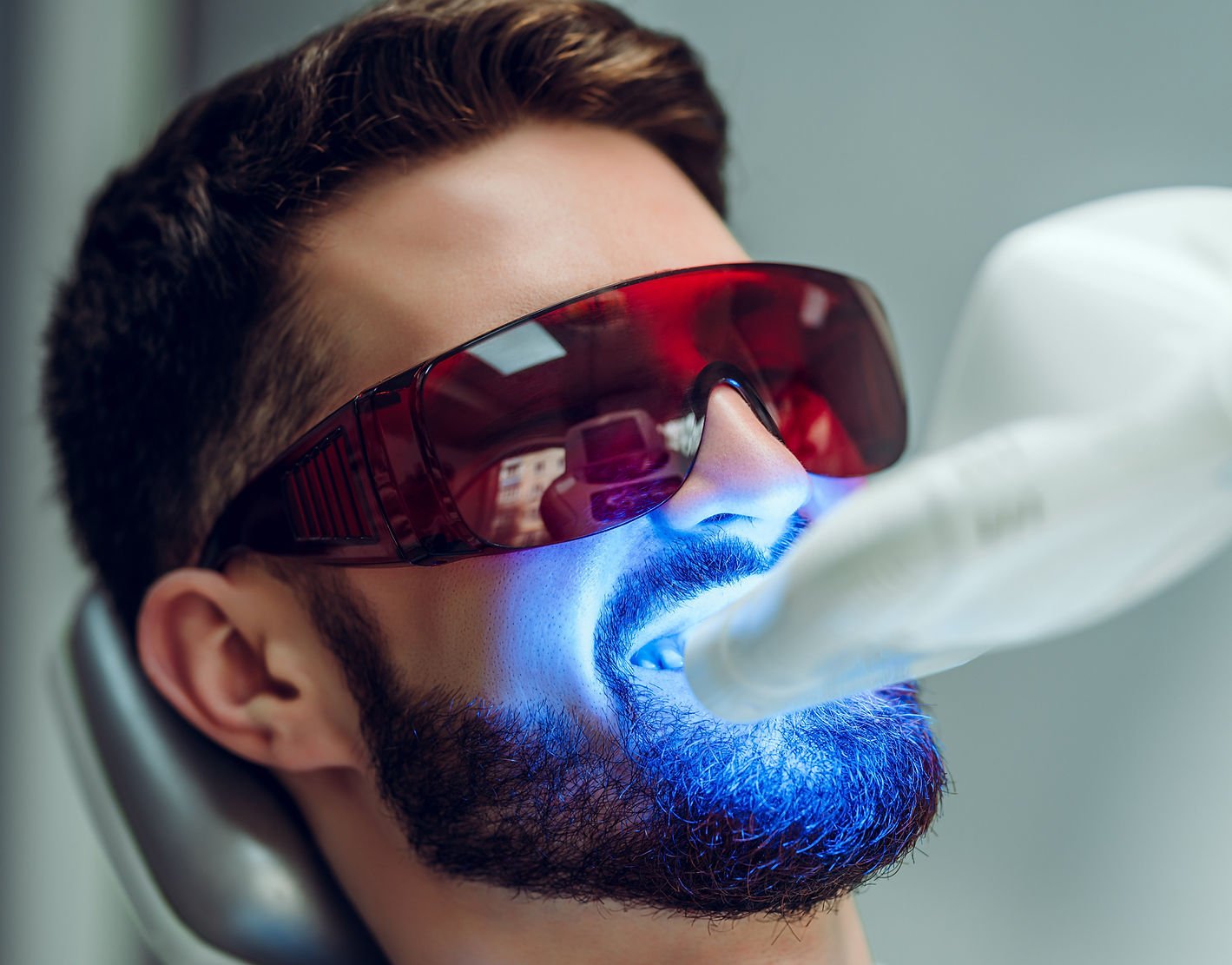 teeth whitening in Canberra