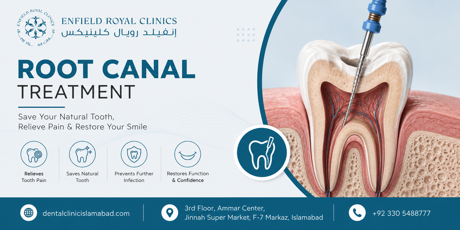 Restore Your Smile with Expert Dental Care Root Canal Treatment :