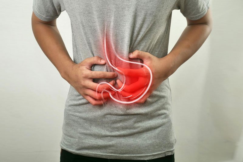 Stomach Cancer