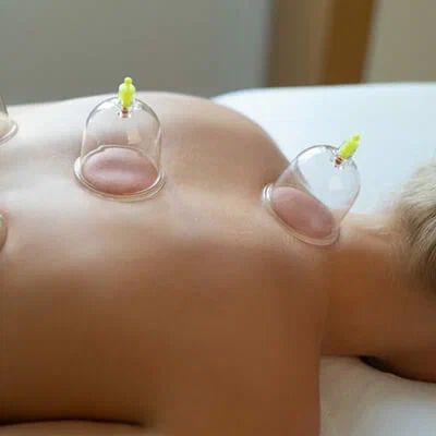 hijama