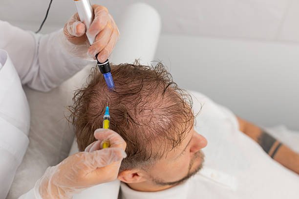 A Next-Generation Solution for Hair Rejuvenation Exosome Hair Therapy in Islamabad: